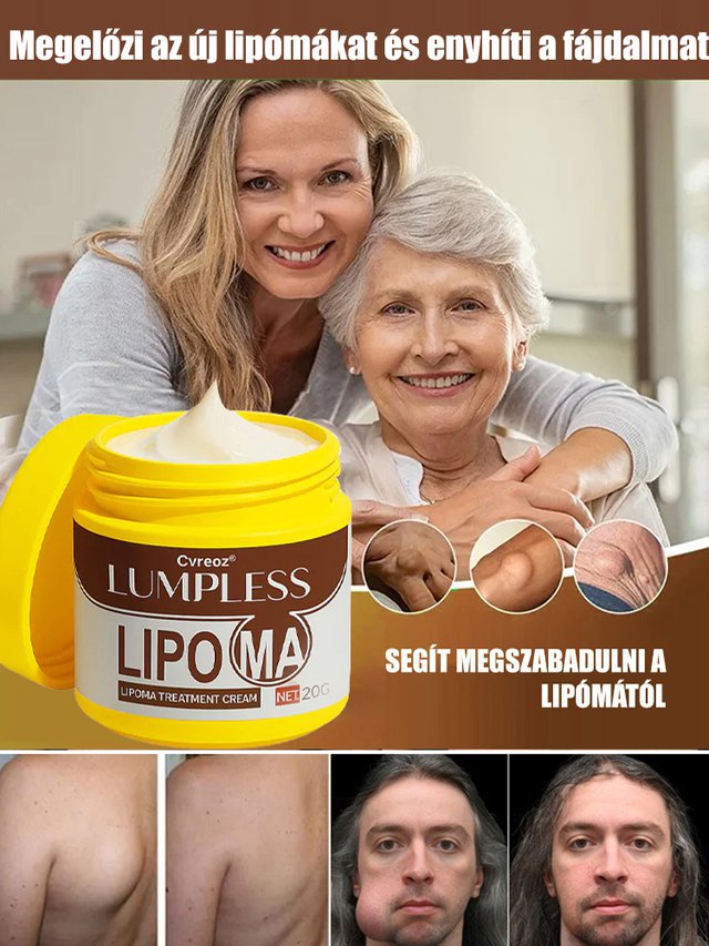 【Egy kenet és nem újul ki】Hét nap alatt eltünteti a lipómákat kenőcs