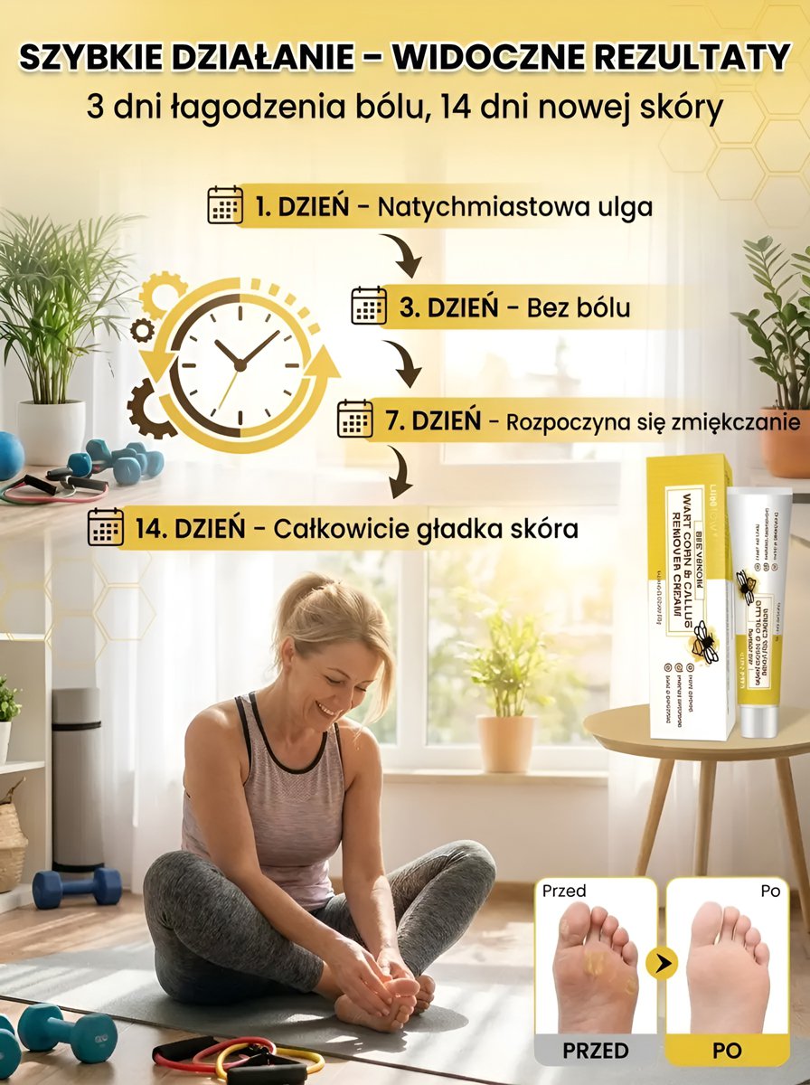 Méhemmérges tyúkszem és bőrkeményedés eltávolító krém