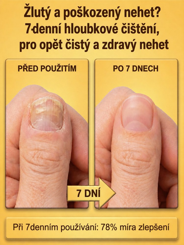 【7 nap a tiszta körmökért】Méhméreg körömápoló cseppek